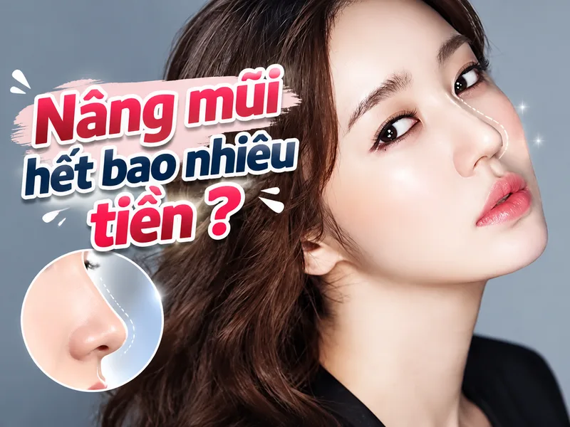 Chi phí nâng mũi phụ thuộc vào phương pháp thực hiện, chất liệu sụn và cơ sở thẩm mỹ lựa chọn.